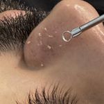 خدمات تخصصی پوست و فیشال سمانه ابراهیمی