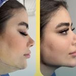 کلینیک زیبایی الماس کاملا اقساطی