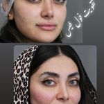 کلینیک زیبایی پوست و لیزر آلن