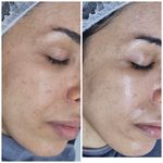 فیشال و پاکسازی پوست درنواب