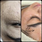 پاکسازی پوست اراک