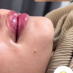 کلینیک زیبایی و جوانسازی پوست و مو الین