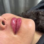 کلینیک زیبایی و جوانسازی پوست و مو الین