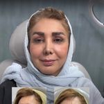 کلینیک زیبایی و جوانسازی پوست و مو الین