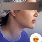 کلینیک زیبایی و جوانسازی پوست و مو الین