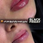 کلینیک زیبایی و جوانسازی پوست و مو الین