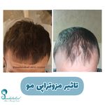 مرکز تخصصی لیزر و زیبایی سعادت آباد