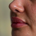 کلینیک زیبایی پروما