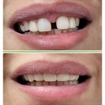 دندانپزشکی دکتر مجتبی نیکوزاده