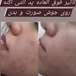 فیشیال تخصصی سهیلا(ویژه بانوان)
