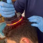 درمان مشکلات کف سر و ضخیم ساقه بهاره