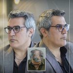 کلینیک پوست مو و زیبایی نوین ایرانا