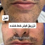 کلینیک پوست مو لیزر ونوس