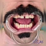 مرکز ایمپلنت و زیبایی یاس