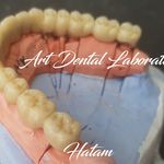 لابراتوار دندانسازی آرت دنتال