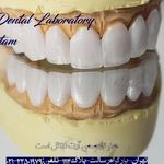 لابراتوار دندانسازی آرت دنتال