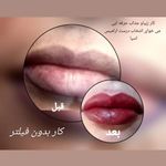 مرکز ماساژ ارامیس اسپا(ویژه بانوان)