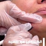 کلینیک لیزر پوست و مو پرستو محمدی