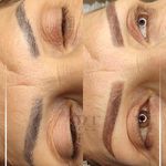 مرکز میکروبلیدینگ شیدینگ ریموو اسکالپ