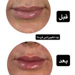 کلینیک زیبایی لاغری لیزر دانا