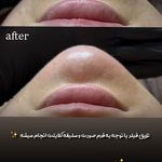 مرکز لیزر و کلینیک زیبایی پریفا