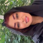 میکرو لیلی.متخصص شیدلب