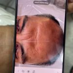 کلینیک پوست،مو و لیزر زینا مختاری