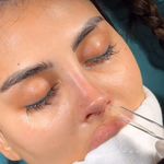 کلینیک زیبایی الماس کاملا اقساطی
