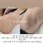 خدمات فیشال پاکسازی، اسکالپ اسکراپ ماهرخ