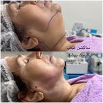 کلینیک تخصصی لیزر ،پوست و‌زیبایی بهشاد