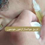 کلینیک زیبایی هانیل