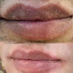 مرکز آرایش دائم وریموو وپوست گندم فلاحی