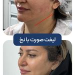 کلینیک زیبایی و جوانسازی پوست و مو الین