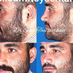 دکتر سام تویسرکانی