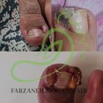 پدیکور و پدولوژیست فرزانه محمدی