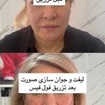 کلینیک زیبایی و لیزر دکتر آزاده اسماعیلی