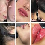 مرکز لیزر و فیلر وجوانسازی وزیبایی شاینا