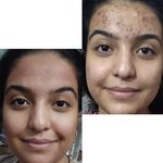 خدمات تخصصی فیشیال آیسو