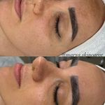خدمات تخصصی  پوست مهشید