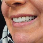 مطب دندانپزشکی دکتر فاطمه محمودی افصح