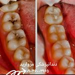 دندانپزشکی و دندانسازی مروارید