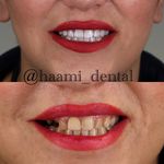 دندانپزشکی حامی (طرف قراردادبیمه نیستیم)