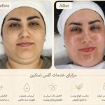 آکادمی پاکسازی و فیشال cip فریماه دلدار