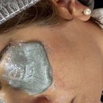 فیشال و پاکسازی تخصصی پوست