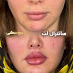 دکتر محمود قهقایی فوق تخصص جراحی پلاستیک