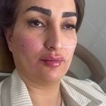 کلینیک لیزر و پوست و مو و زیبایی آرشینو