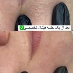 كلينيك زيبايي پوستينو