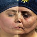 برفین اسکین