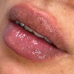 برفین اسکین