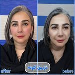 برفین اسکین